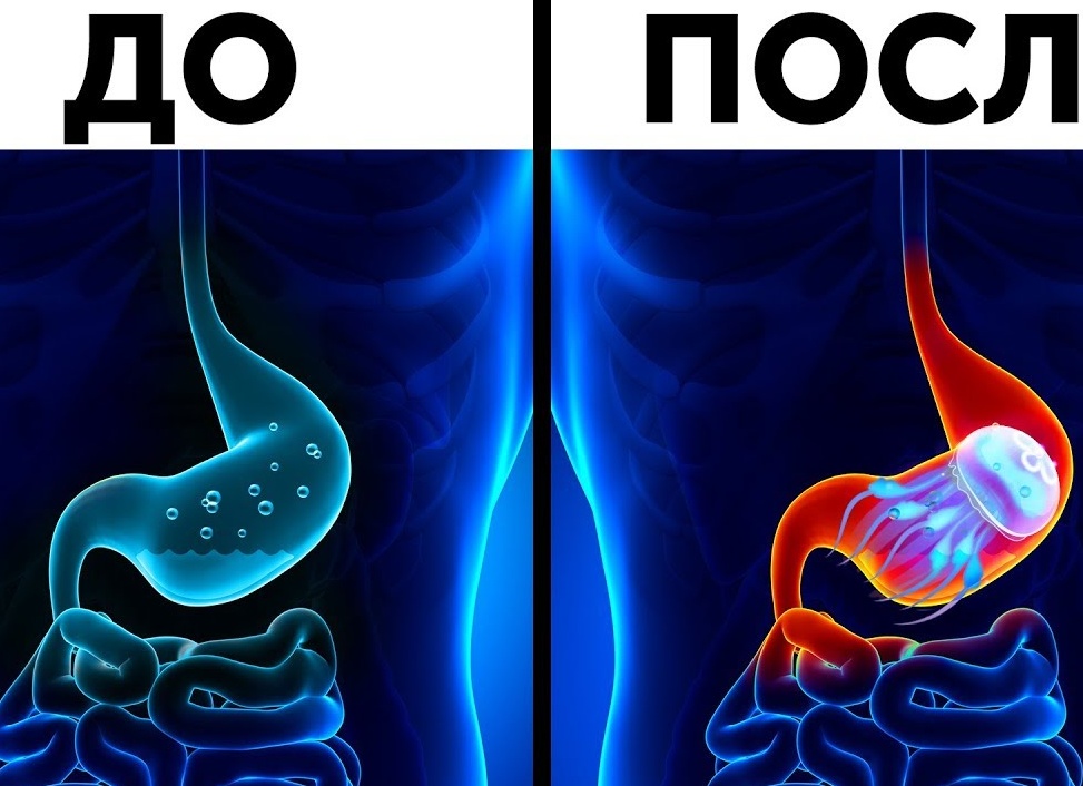 Что будет, если съесть медузу