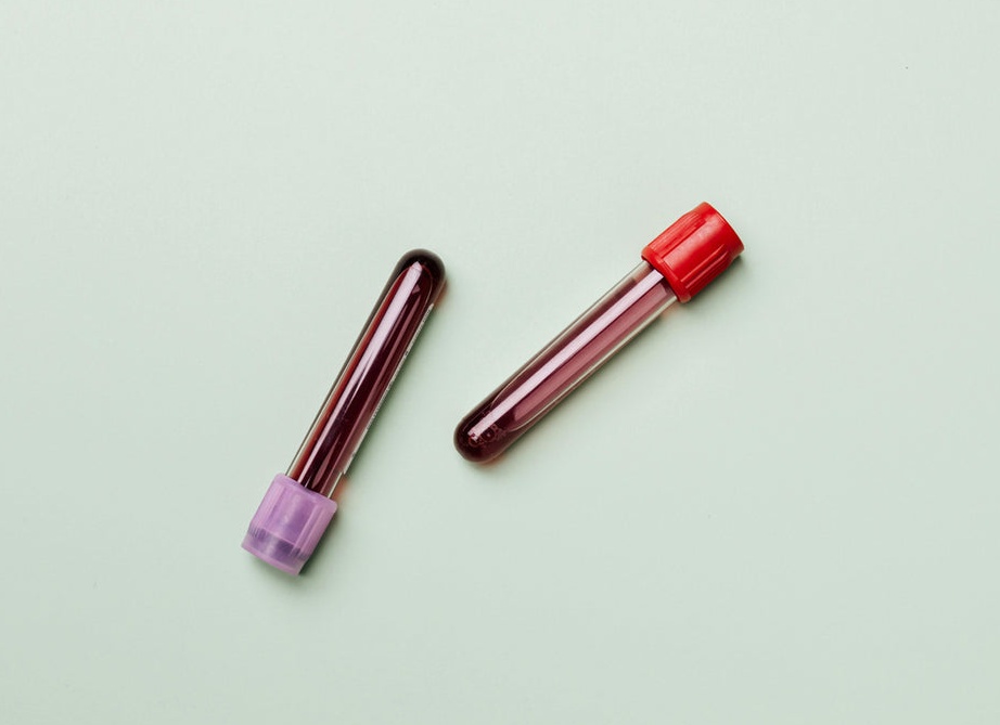 Работает ли диета по группе крови