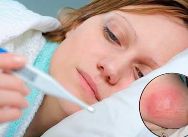 Почему возникает лактостаз и как его лечат