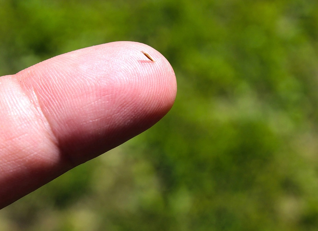 Что будет, если не вытащить занозу