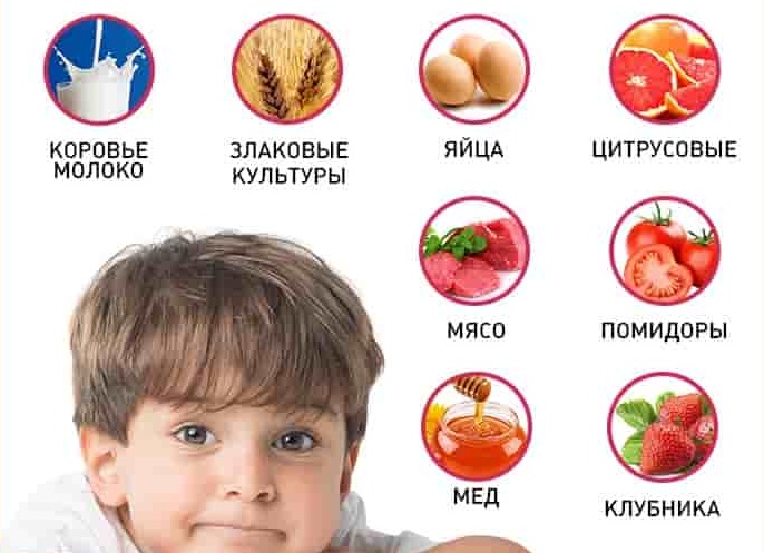 Какие продукты могут облегчить аллергию