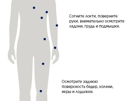 Можно ли заболеть раком из-за солярия
