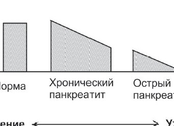 Лечит или калечит: может ли еда навредить или помочь желчному и поджелудочной