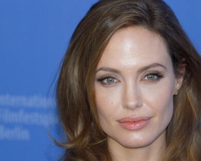 Стоит ли делать «углы Джоли»