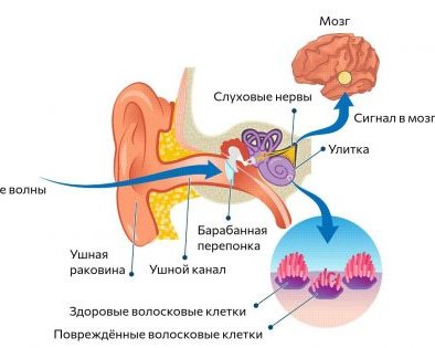 Почему звенит в ушах и как избавиться от этого