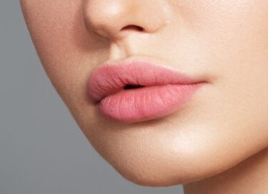 Гиалуроновые усы: почему после увеличения губ появляется такой эффект и как от него избавиться