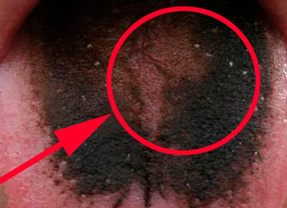 Что будет, если съесть грифель от карандаша