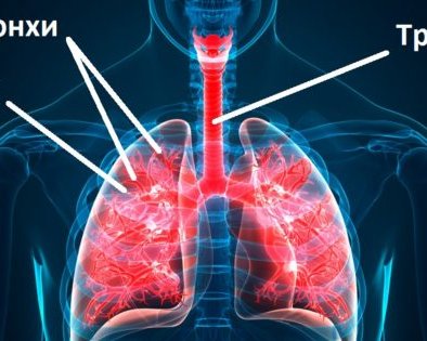 Чем опасен трахеит и как его лечить