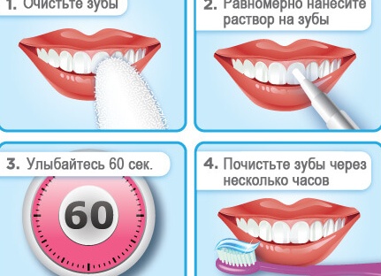 Как отбелить зубы в домашних условиях