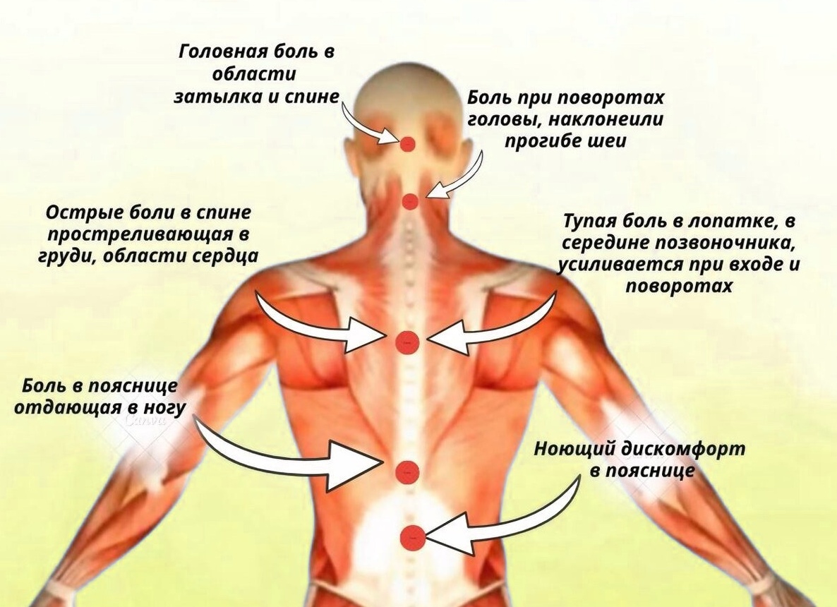 Карта боли — что болит и кто это лечит