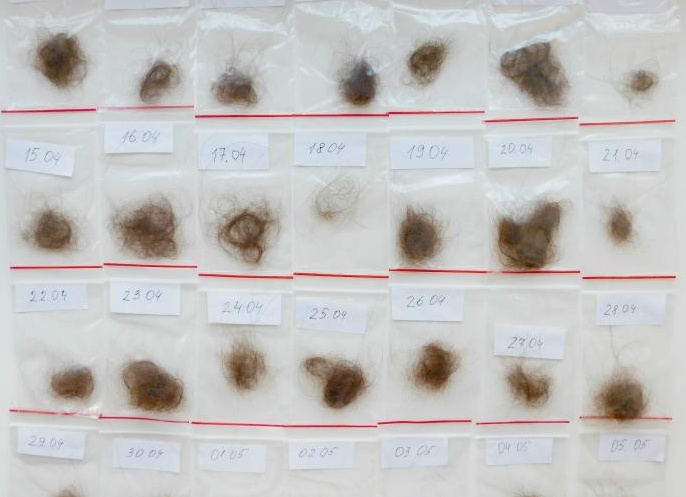 Какова норма выпадения волос