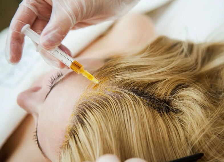 Кому нужна мезотерапия для волос