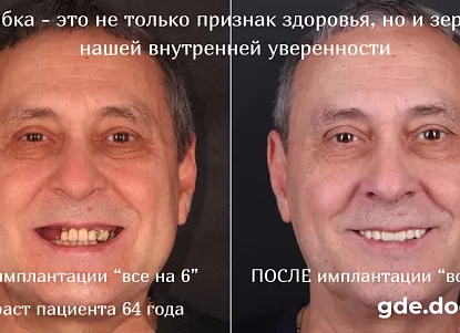 Почему зубы портятся с возрастом и что с этим делать