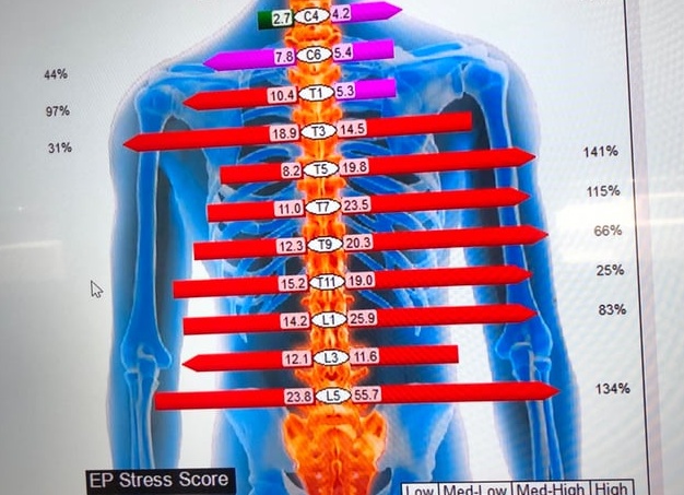 Что такое хиропрактика и может ли она навредить