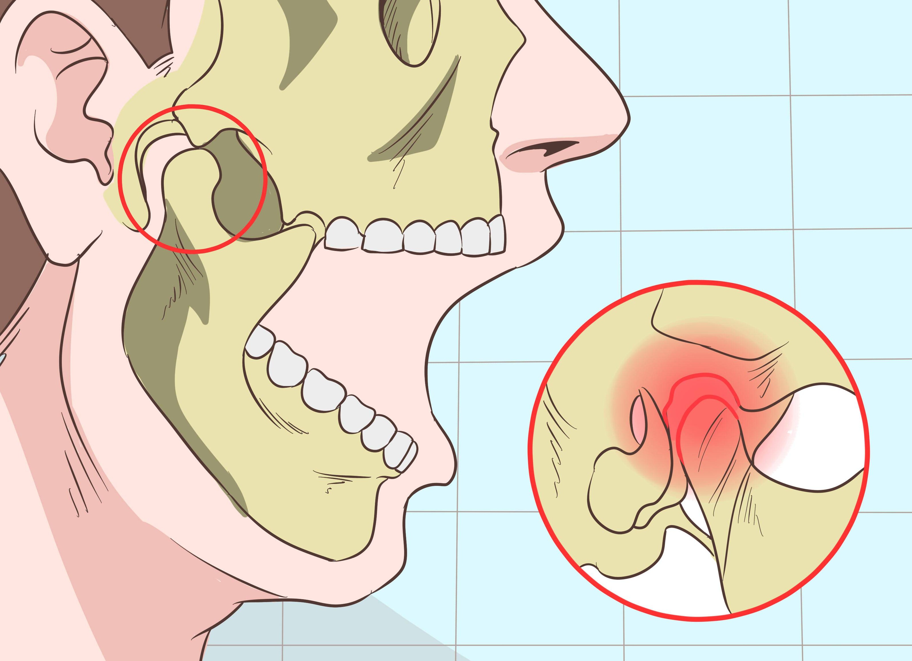 Почему болит челюсть и что с этим делать