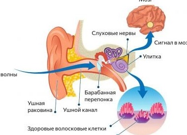 Почему звенит в ушах и как избавиться от этого