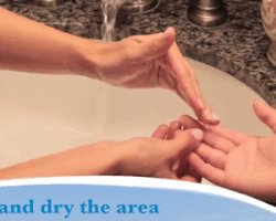 Как быстро вытащить занозу и не заработать новых проблем