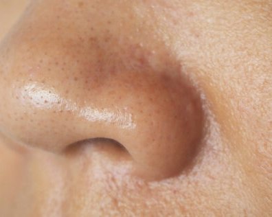 Пора признаться: чистка лица не спасёт от забитых и расширенных пор