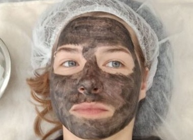 Правда ли карбоновый пилинг сделает кожу здоровой и сияющей